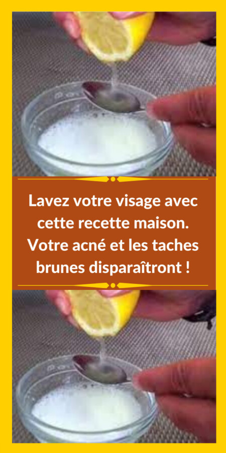 Astuces beauté visage