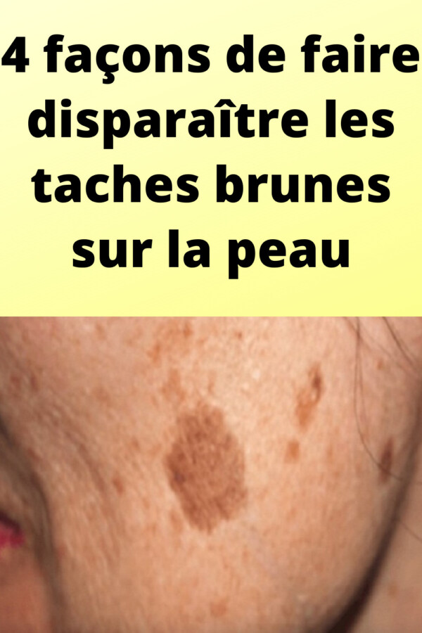 Astuces beauté visage